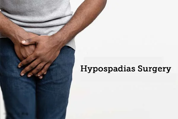 Hypospadias Surgery